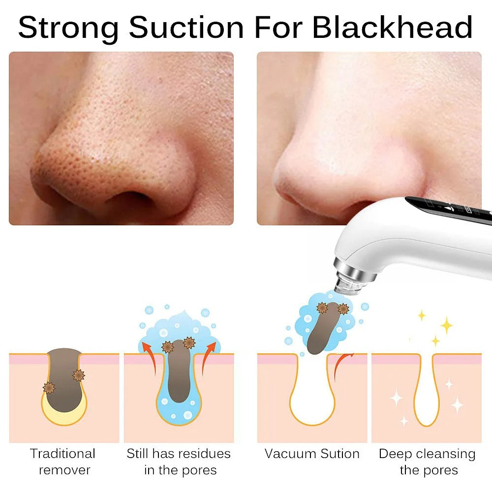 Blackhead Removal Pore Vacuum Face Cleaner Electric Pimple Black Head Remover USB Rechargeable Water Cycle Facial Cleaning Tools